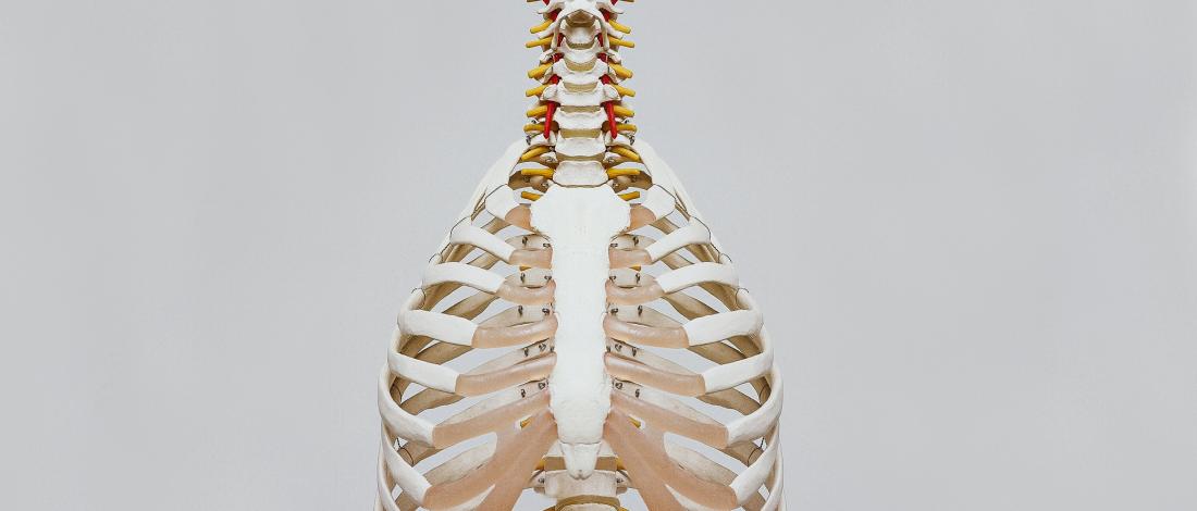 Ankylosing Spondylitis